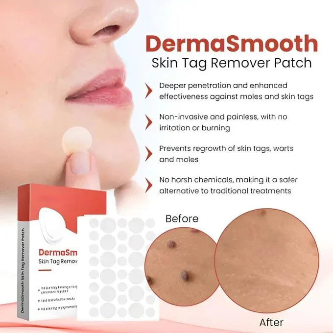 Pack of 2 - DERMA SMOOTH® SKIN TAG REMOVER PATCH – FLAWLESS SKIN