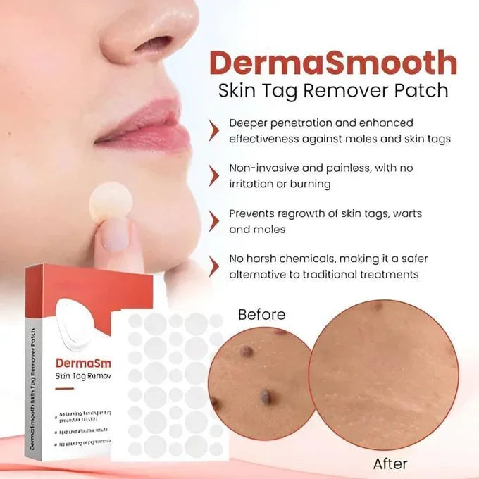 Pack of 2 - DERMA SMOOTH® SKIN TAG REMOVER PATCH – 288 Patches
