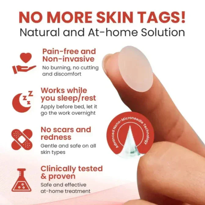 DERMA SMOOTH® SKIN TAG REMOVER PATCH – 72 Patches