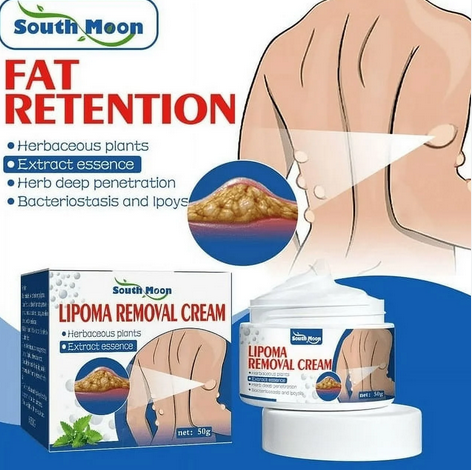 South Moon Lipoma Removal Cream