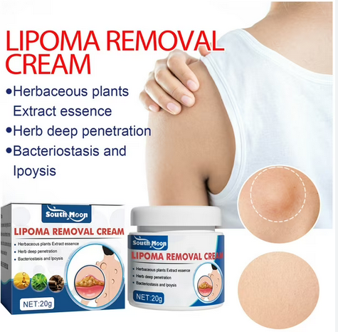 South Moon Lipoma Removal Cream