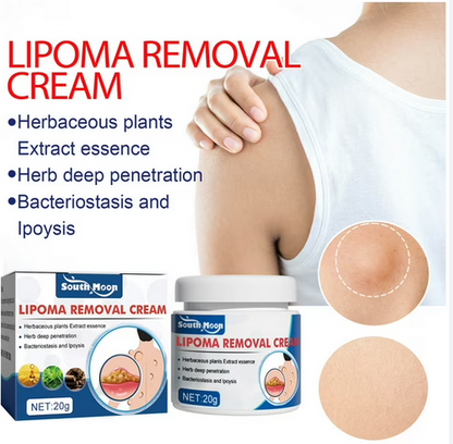 South Moon Lipoma Removal Cream