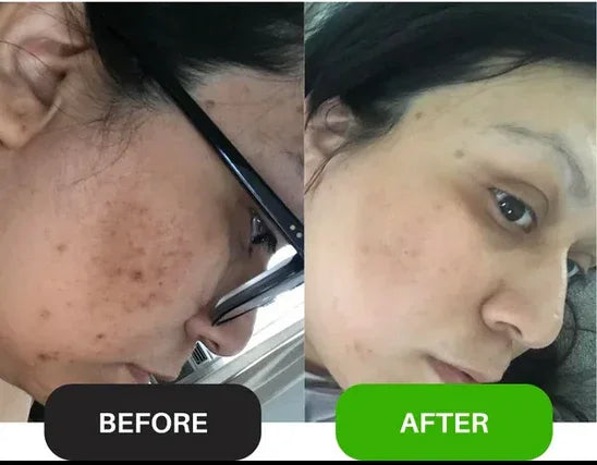 Wiki Special Cream - SKIN CARE NIGHT BEAUTY
